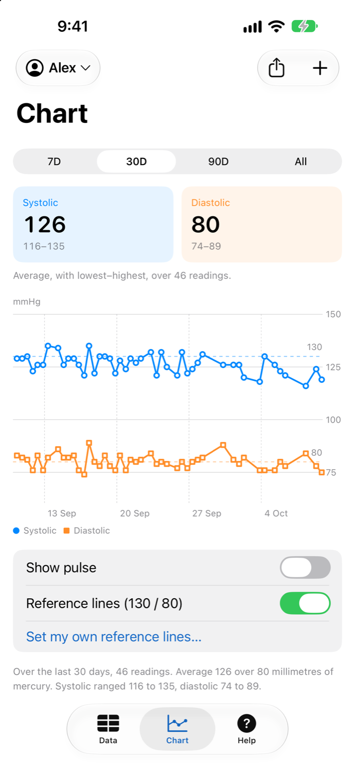 Chart of systolic and diastolic readings over 30 days